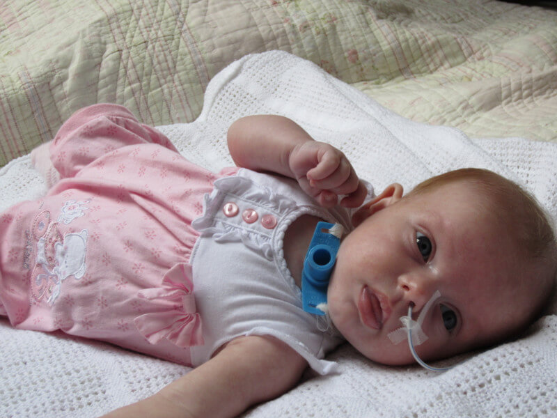 Трахеостомия