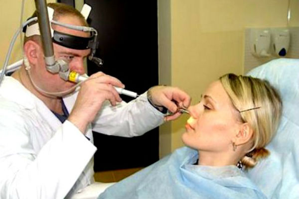 Диагностика ринита