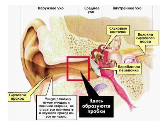 Наружный отит или воспаление наружного уха. Симптомы