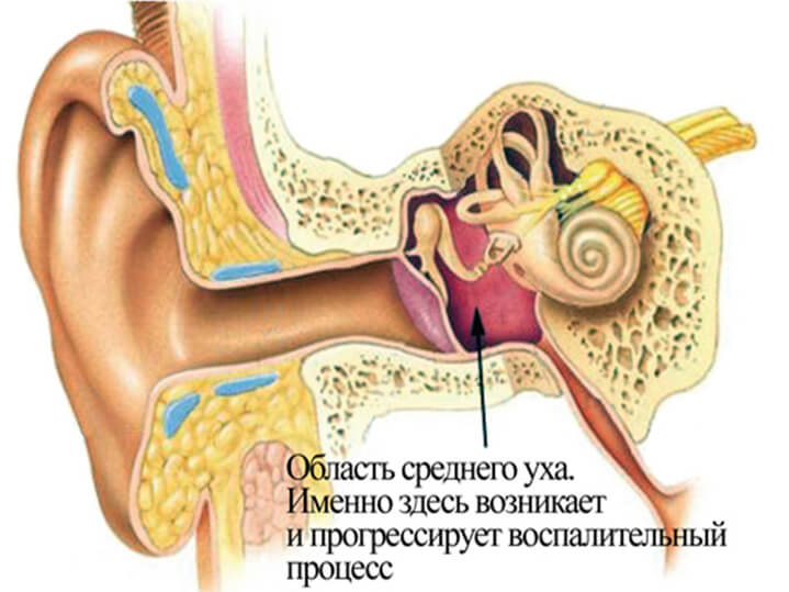 Цефтриаксон при отите среднего уха