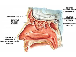Острое воспаление гайморовой пазухи может стать показанием для лечения гайморита антибиотиками