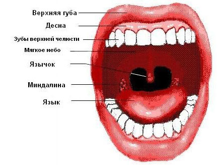 Хронического тонзиллита признаки. Как найти миндалины